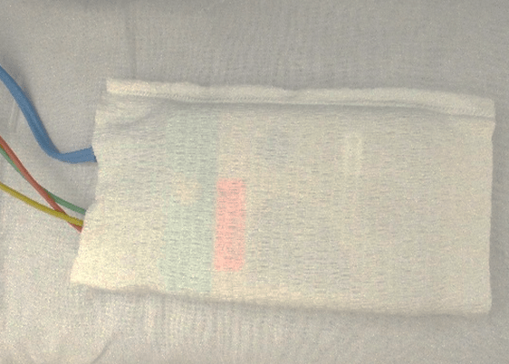  心電図モニターの送信機に装着