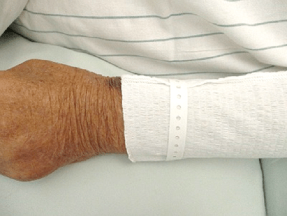 ネームバンドやリムホルダーの下に装着