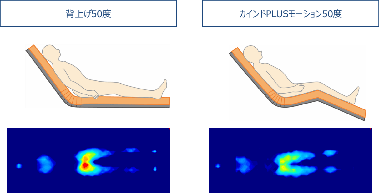 【標準型ベッドと「メーティスPRO」 背上げ時の体圧】