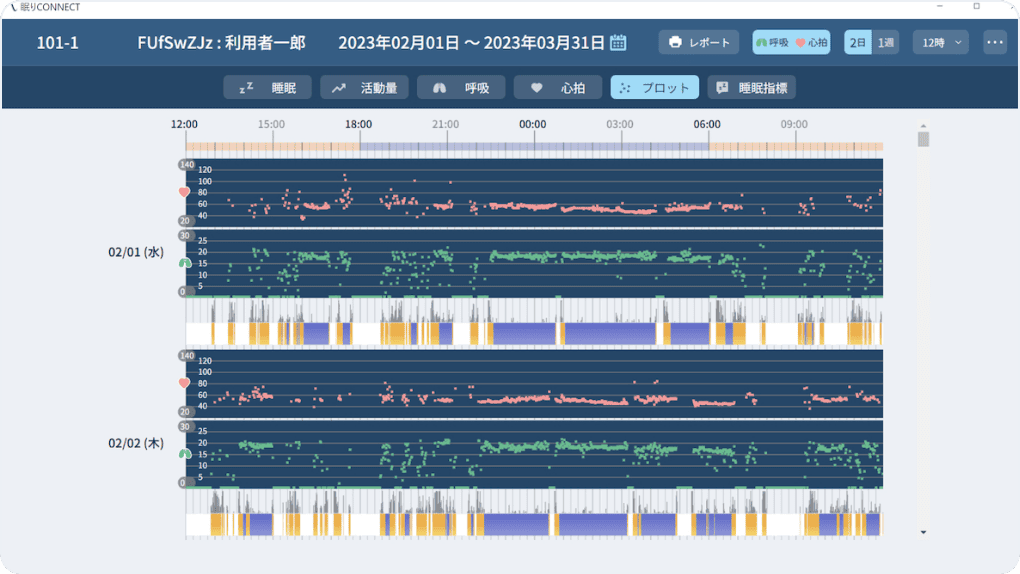 プロット表示